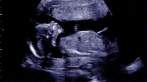 Mãos de pais segurando um pequeno pé de bebê, simbolizando a perda e o luto perinatal.
