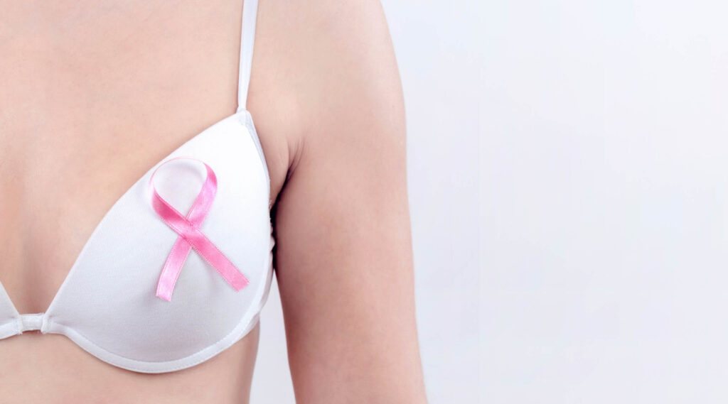Reconstrução Mamária e Oncoplástia: Um passo importante no tratamento do câncer.