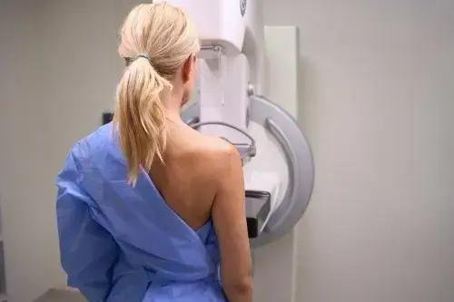 Ministério da Saúde atualiza diretriz sobre mamografia para mulheres a partir dos 40 anos