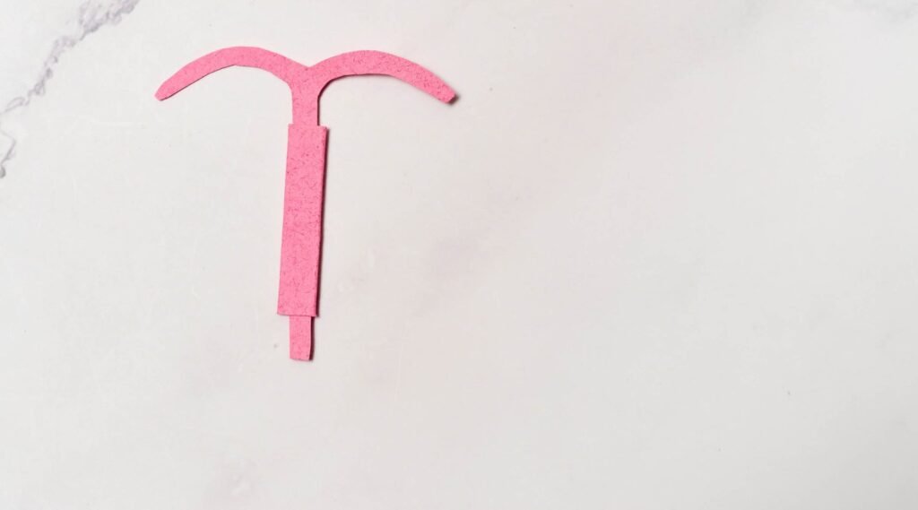 Métodos Contraceptivos: DIU Mirena, Kylena, Cobre e Prata.