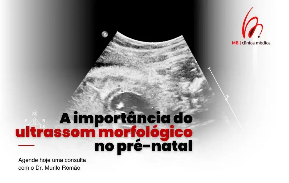 A importância do ultrassom morfológico no pré-natal