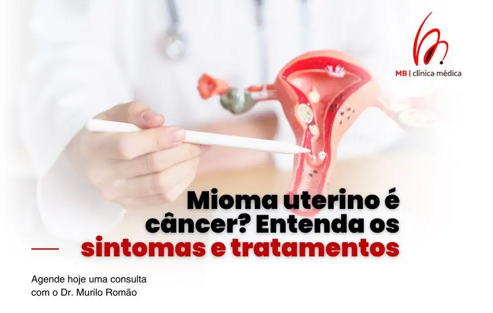 Mioma uterino é câncer? Entenda os sintomas e tratamentos