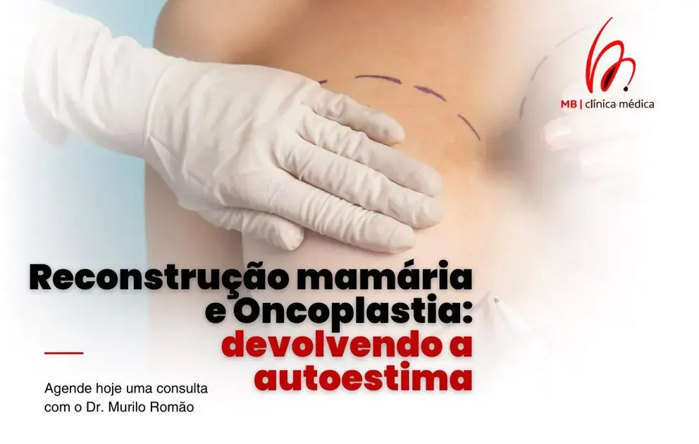 Reconstrução mamária e Oncoplastia: devolvendo a autoestima
