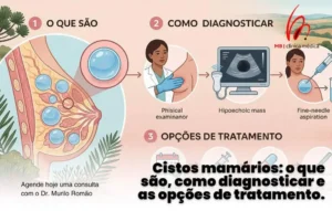 Cistos na Mama: O Que São e Como Lidar Com Eles